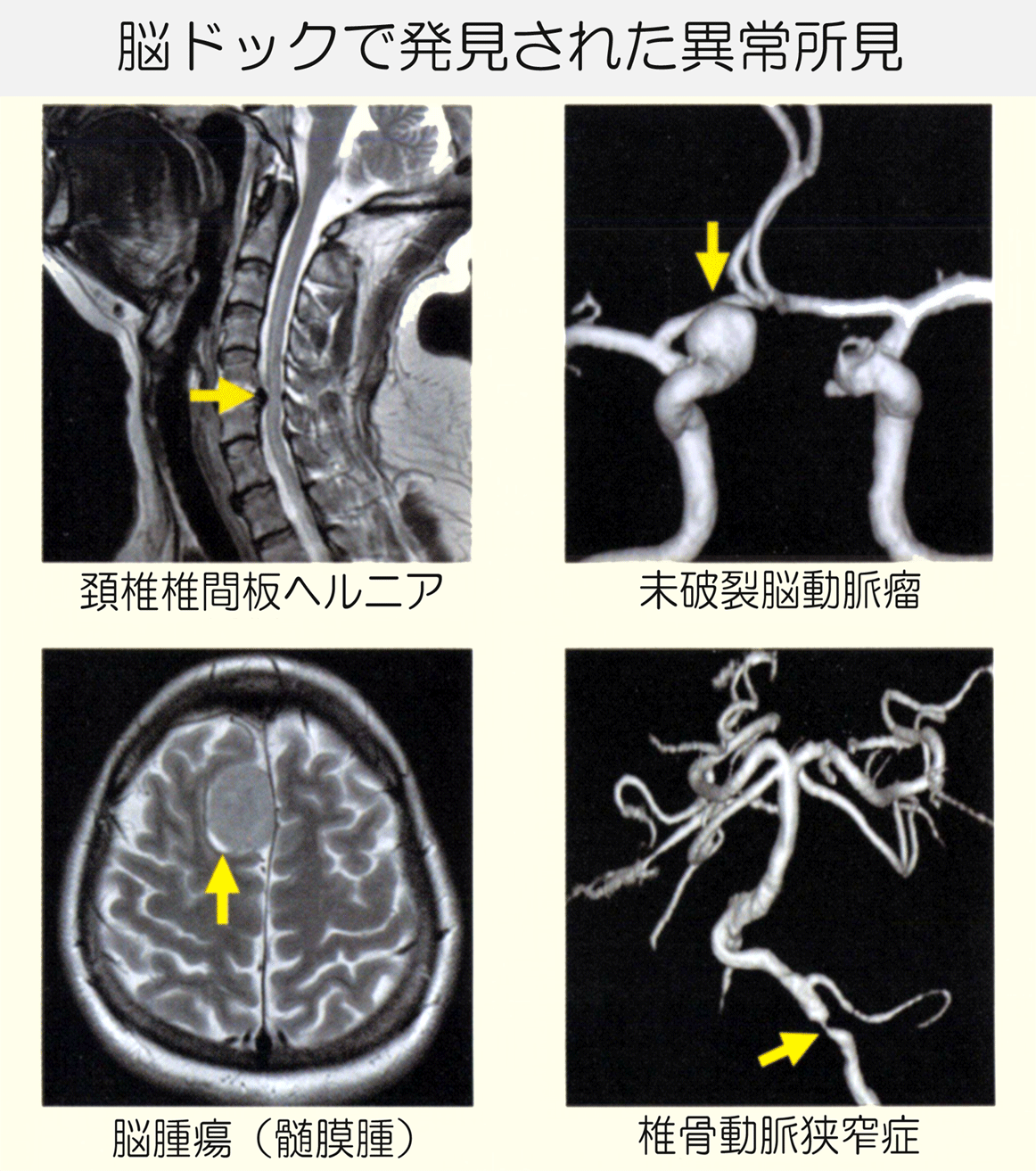 脳ドック | 厚地脳神経外科病院